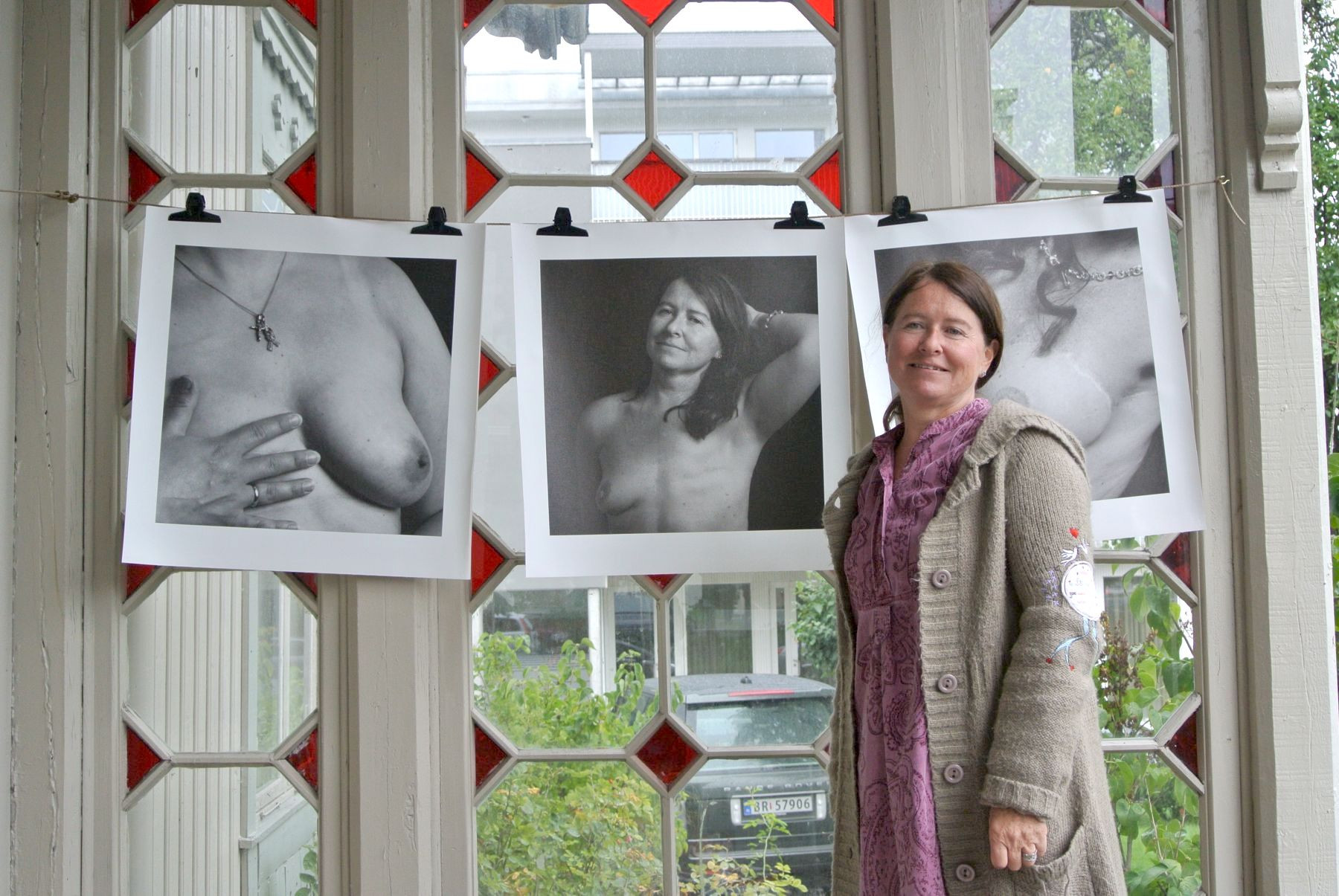 Turd Gyllenhammer photographed with her photos of her breast surgery after breast cancer